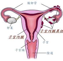 子宫内膜异位症-嘉安试管婴儿中心,不孕症,试管婴儿,人工受孕,冷冻卵子