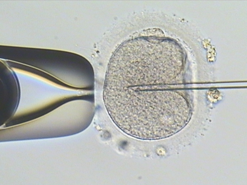 单一精虫显微授精术-嘉安试管婴儿中心,不孕症,试管婴儿,人工受孕,冷冻卵子