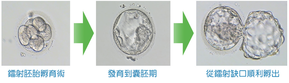  镭射胚胎孵育术-嘉安试管婴儿中心,不孕症,试管婴儿,人工受孕,冷冻卵子